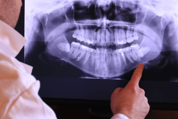 Best Emergency Dental Services for Seniors in Aberdeen, SD